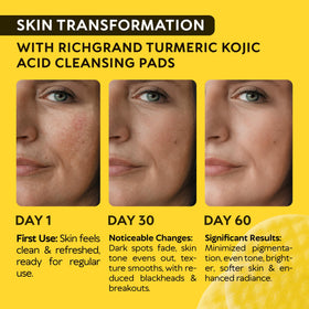RICHGRAND close-up of pad texture highlighting gentle exfoliation benefit