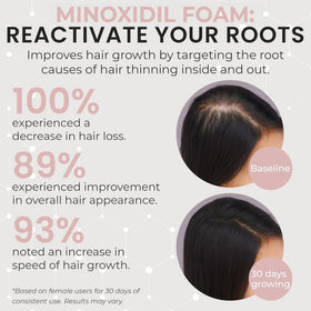 Rida minoxidil foam texture close-up highlighting quick absorption and non-greasy finish