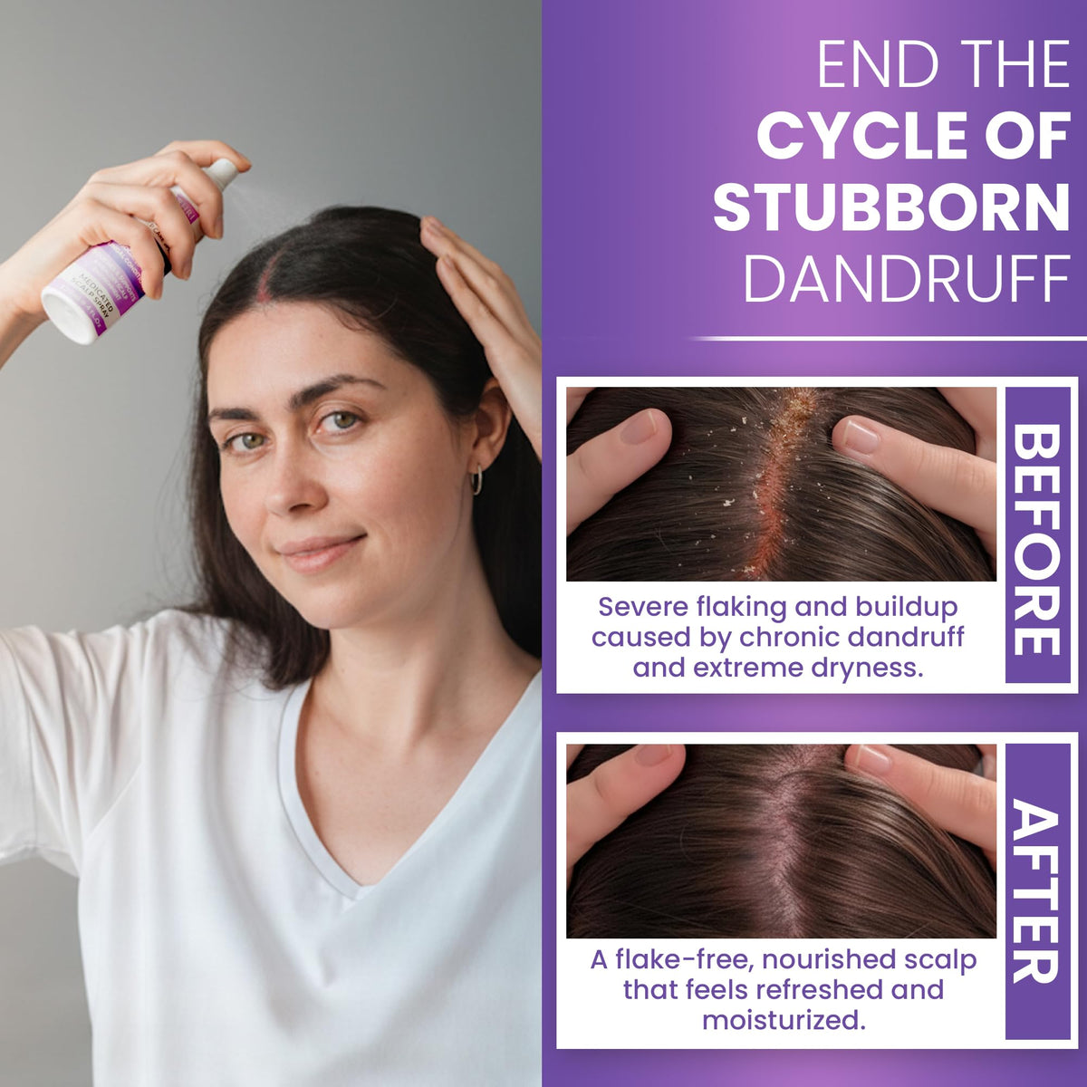 Rida Hair Research Institute Neoketramin being applied to scalp to soothe flakes and itch