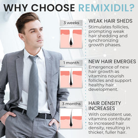 Rida Hair Research Institute beard before and after lifestyle image showing fuller growth