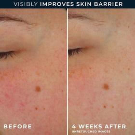 RoC Barrier Renew layered under foundation showing smooth makeup finish