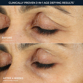 RoC cream application with fingertip demonstrating gentle under-eye spread