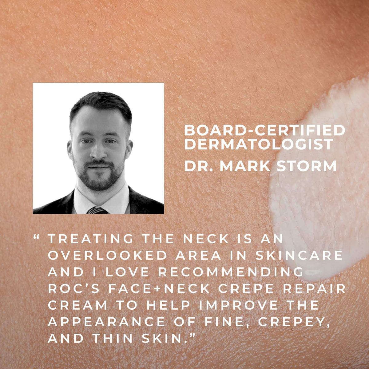 RoC cream smoothing décolleté in lifestyle shot demonstrating visible improvement