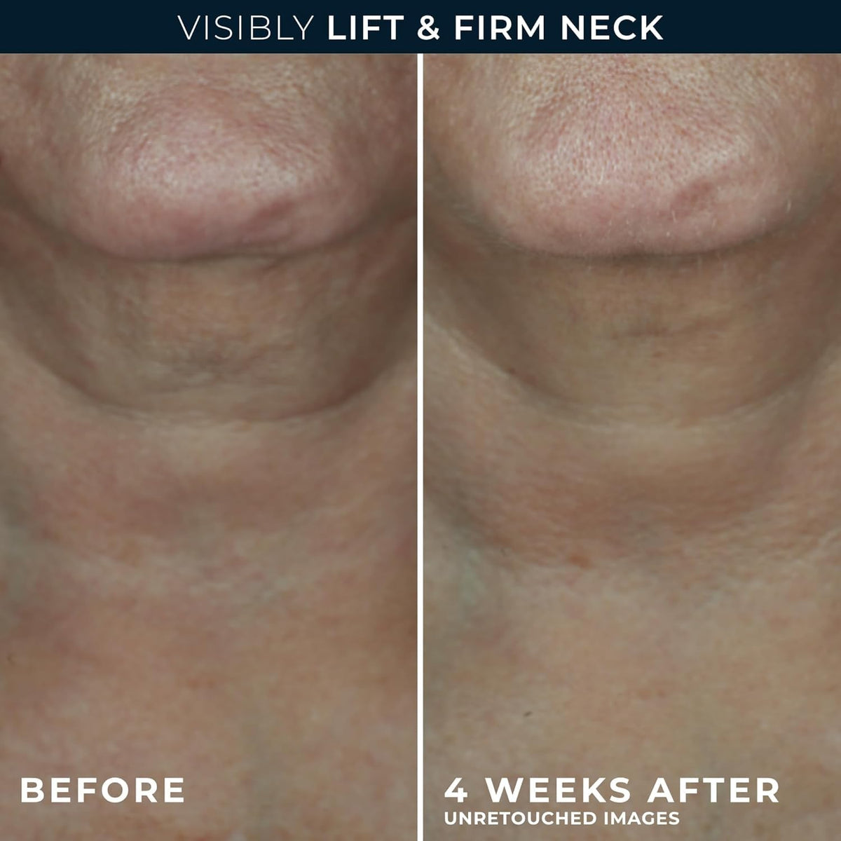 RoC cream being applied to neck demonstrating lifting motion