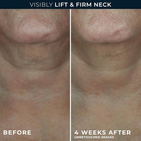 RoC cream being applied to neck demonstrating lifting motion