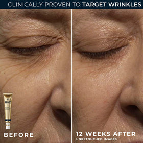 RoC eye cream on fingertip ready for precise under-eye application reducing puffiness