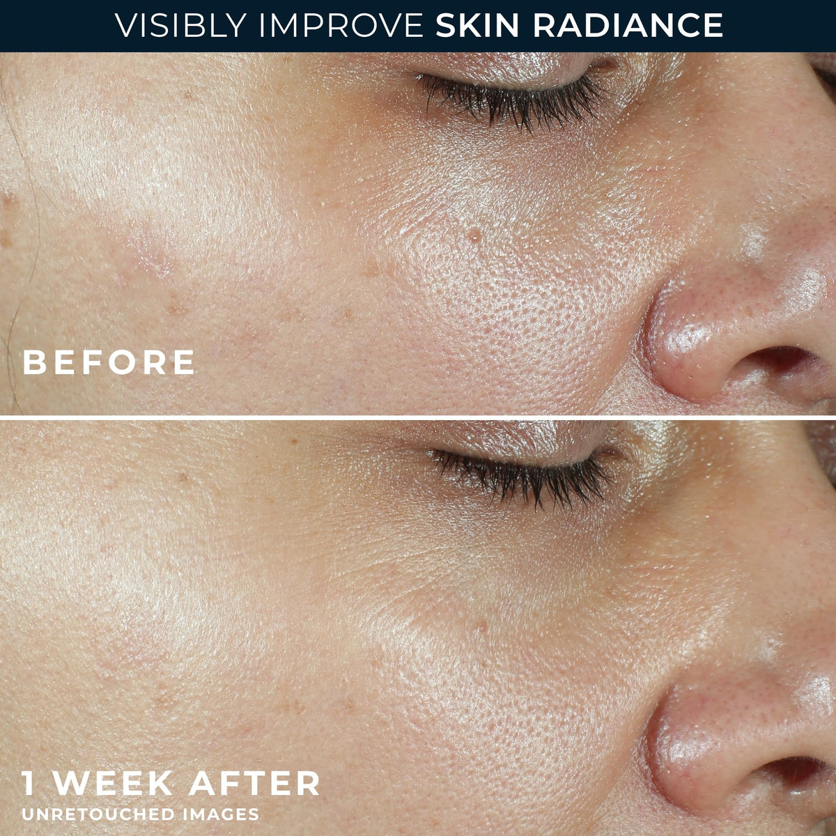 RoC Retinol Eye Cream packette beside tube for targeted under-eye care