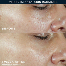RoC Retinol Eye Cream packette beside tube for targeted under-eye care