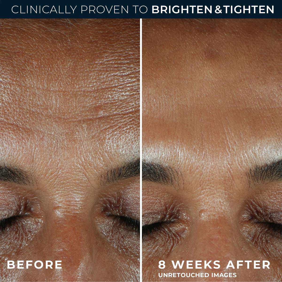 RoC serum applied during morning routine, layers under moisturizer benefit