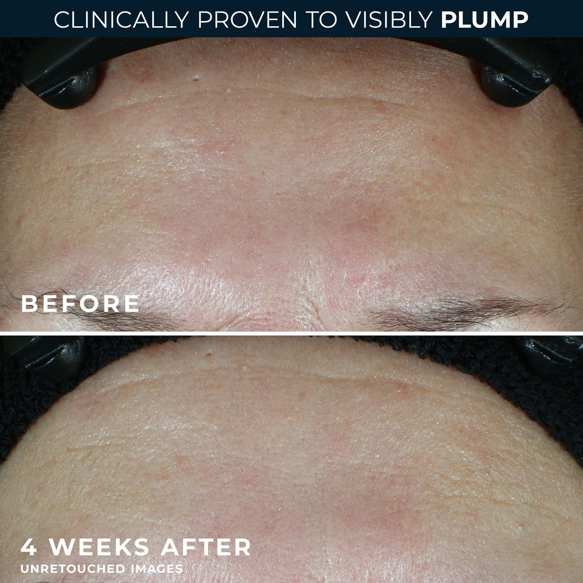 RoC being smoothed onto face and neck, illustrating AM and PM use benefits