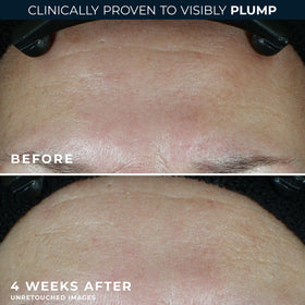 RoC being smoothed onto face and neck, illustrating AM and PM use benefits