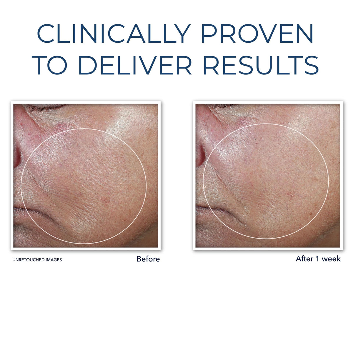 RoC firming serum stick ingredients label, transparency and dermatologist collaboration benefit