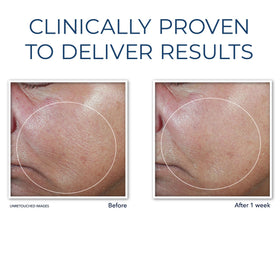 RoC firming serum stick ingredients label, transparency and dermatologist collaboration benefit