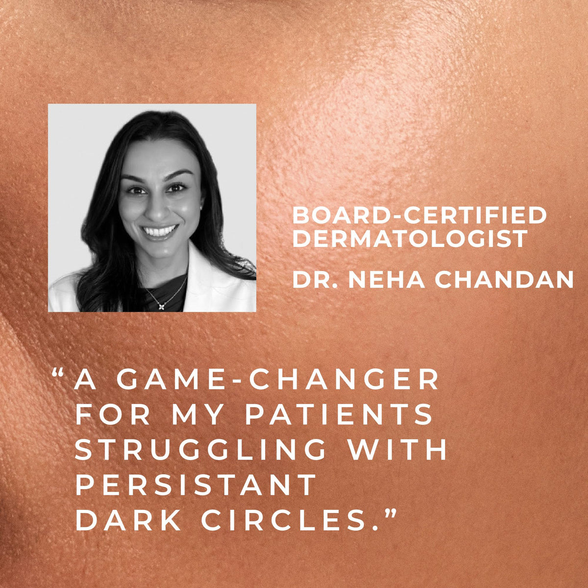 RoC ingredients visual with retinol and niacinamide promoting tone correction