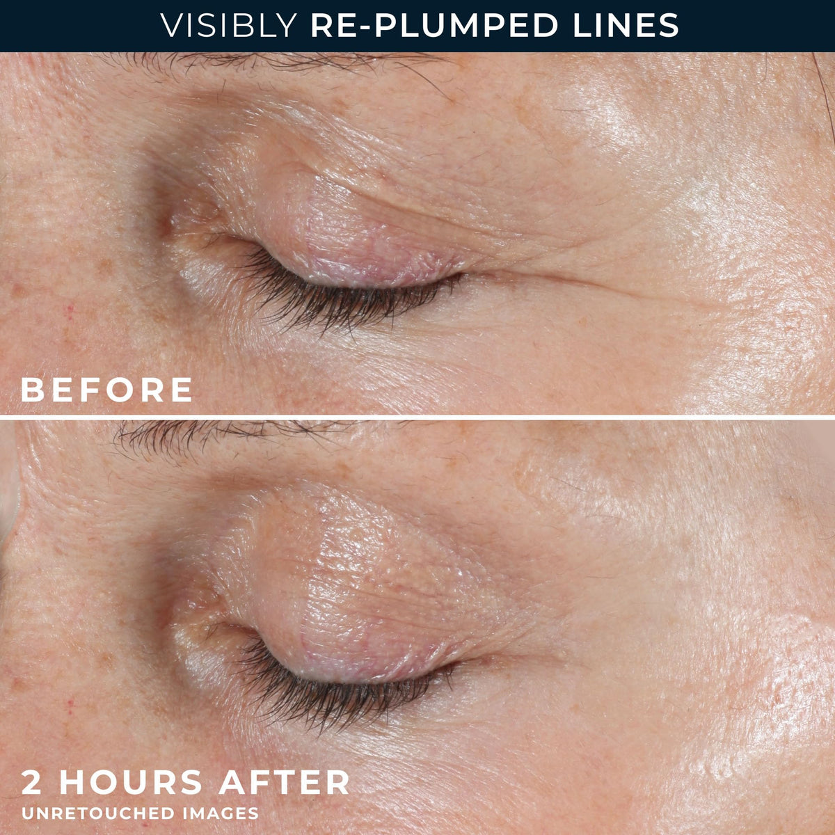 RoC label close-up highlighting retinol, hyaluronic acid, and peptides