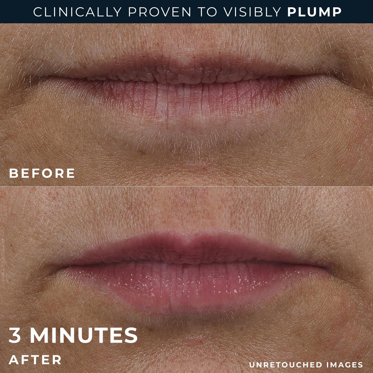 RoC application on lips illustrating instant plumping and definition