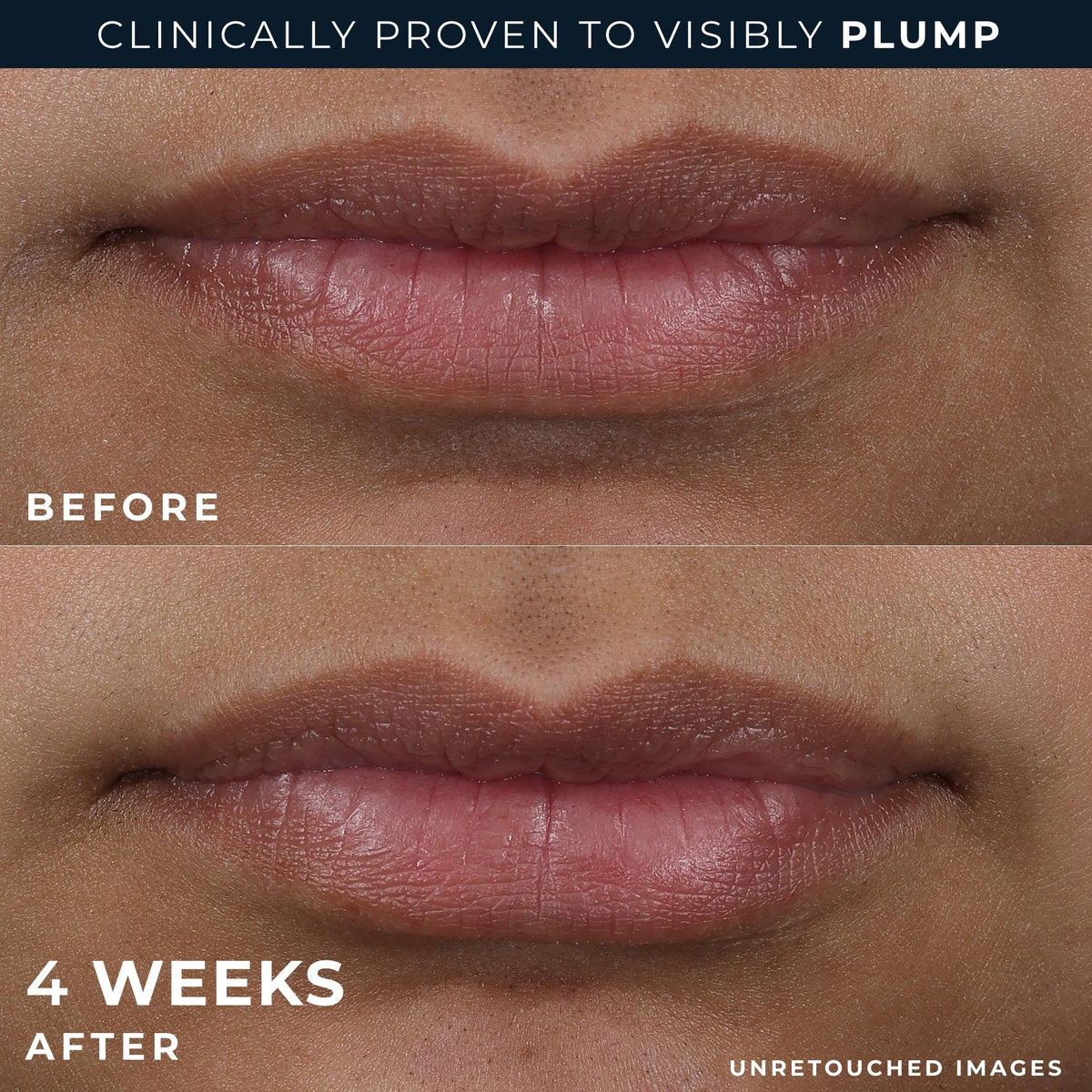 RoC product paired with eye cream packette for dual treatment benefits