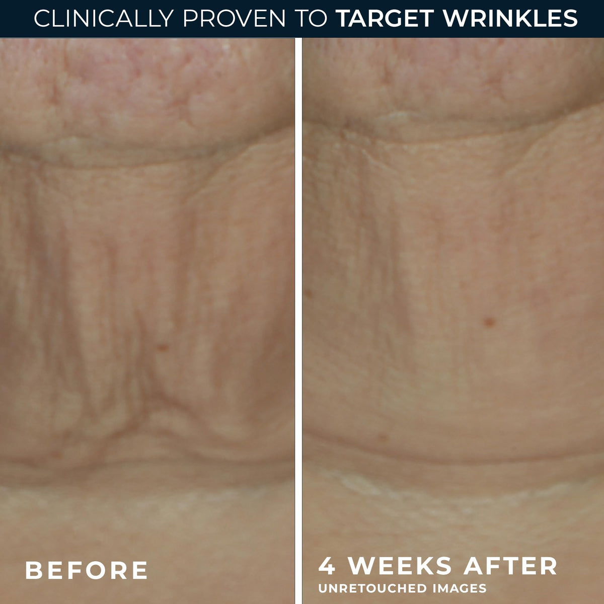 RoC neck and jawline usage showing targeted lift and contouring benefit