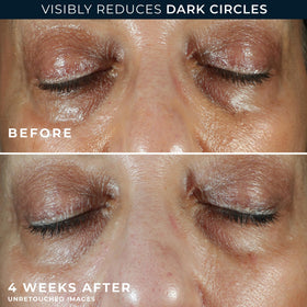 RoC jar next to included night cream packette for full routine