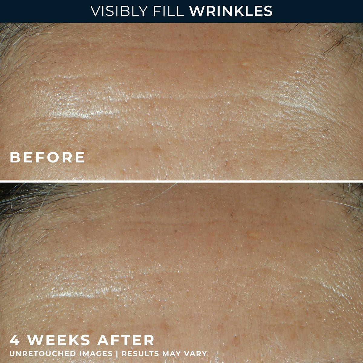 RoC serum on hand showing amount and fast-absorbing benefit