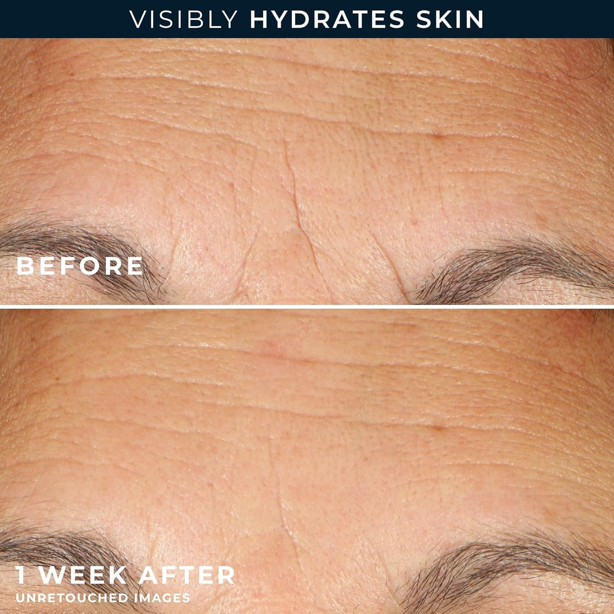 RoC 7-count retinol capsules trial box highlighting complementary wrinkle-support