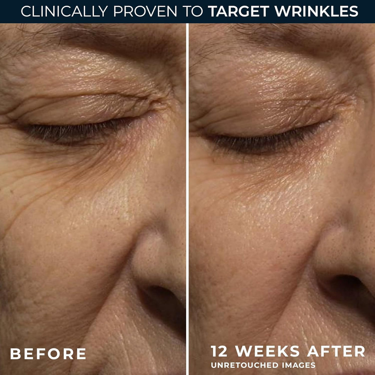 RoC label and ingredient panel highlighting active retinol