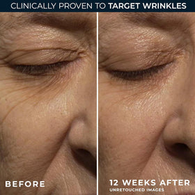 RoC label and ingredient panel highlighting active retinol