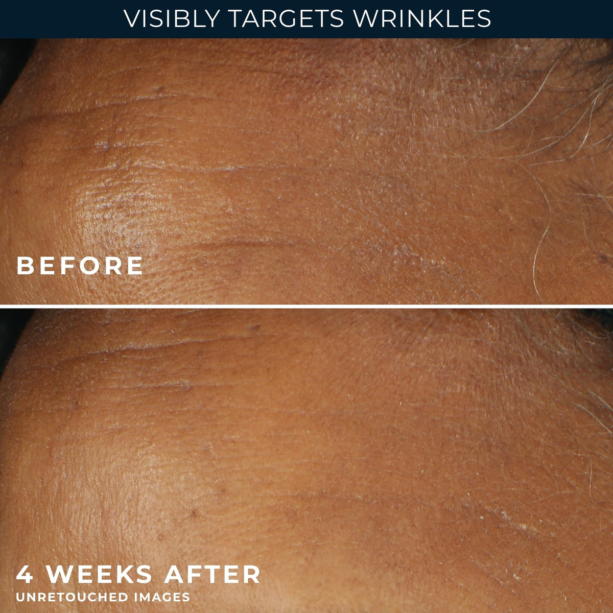 RoC sunscreen and retinol combo graphic for daytime protection