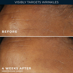 RoC sunscreen and retinol combo graphic for daytime protection