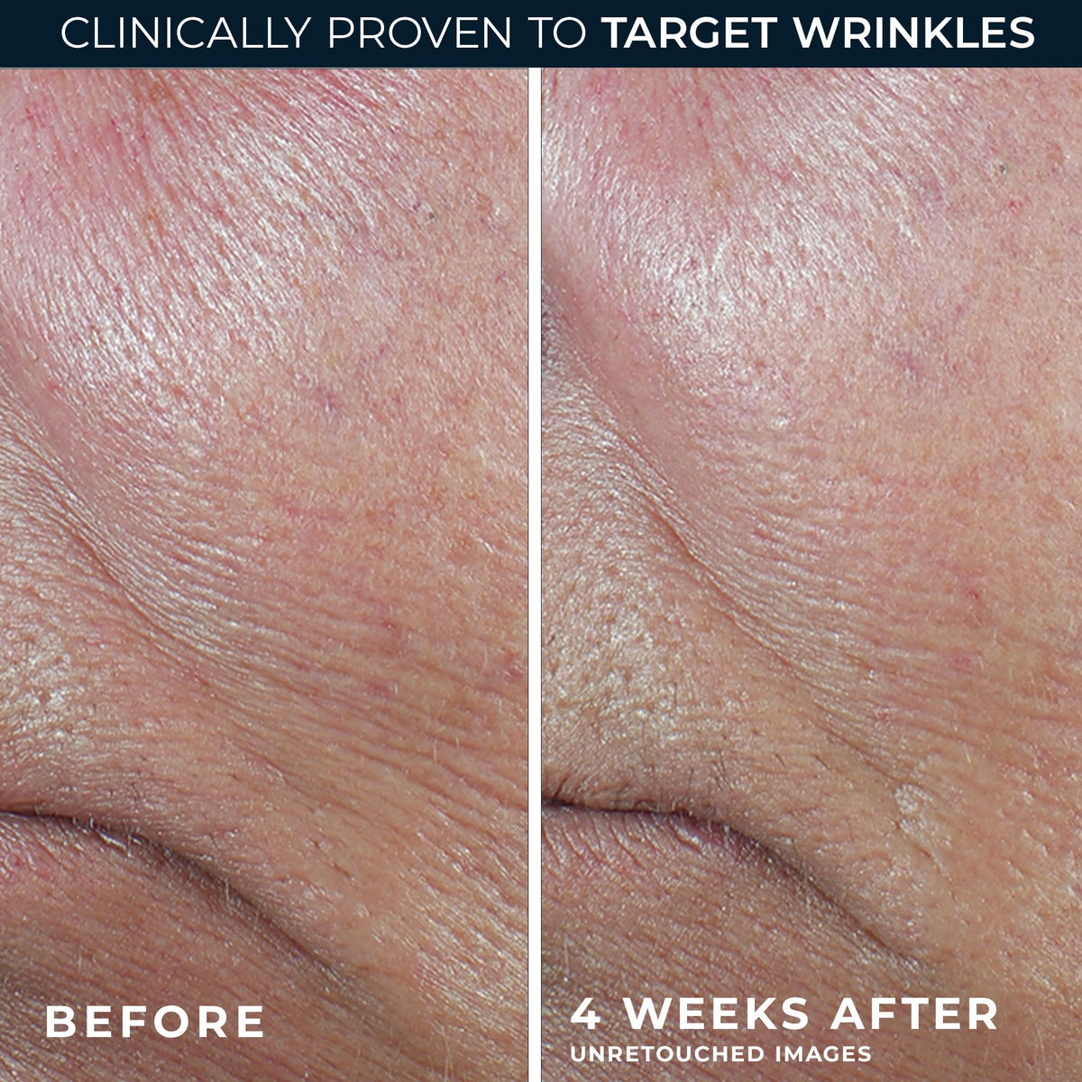 RoC retinol eye cream packette included with stick for complementary under-eye care benefit