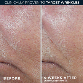 RoC retinol eye cream packette included with stick for complementary under-eye care benefit