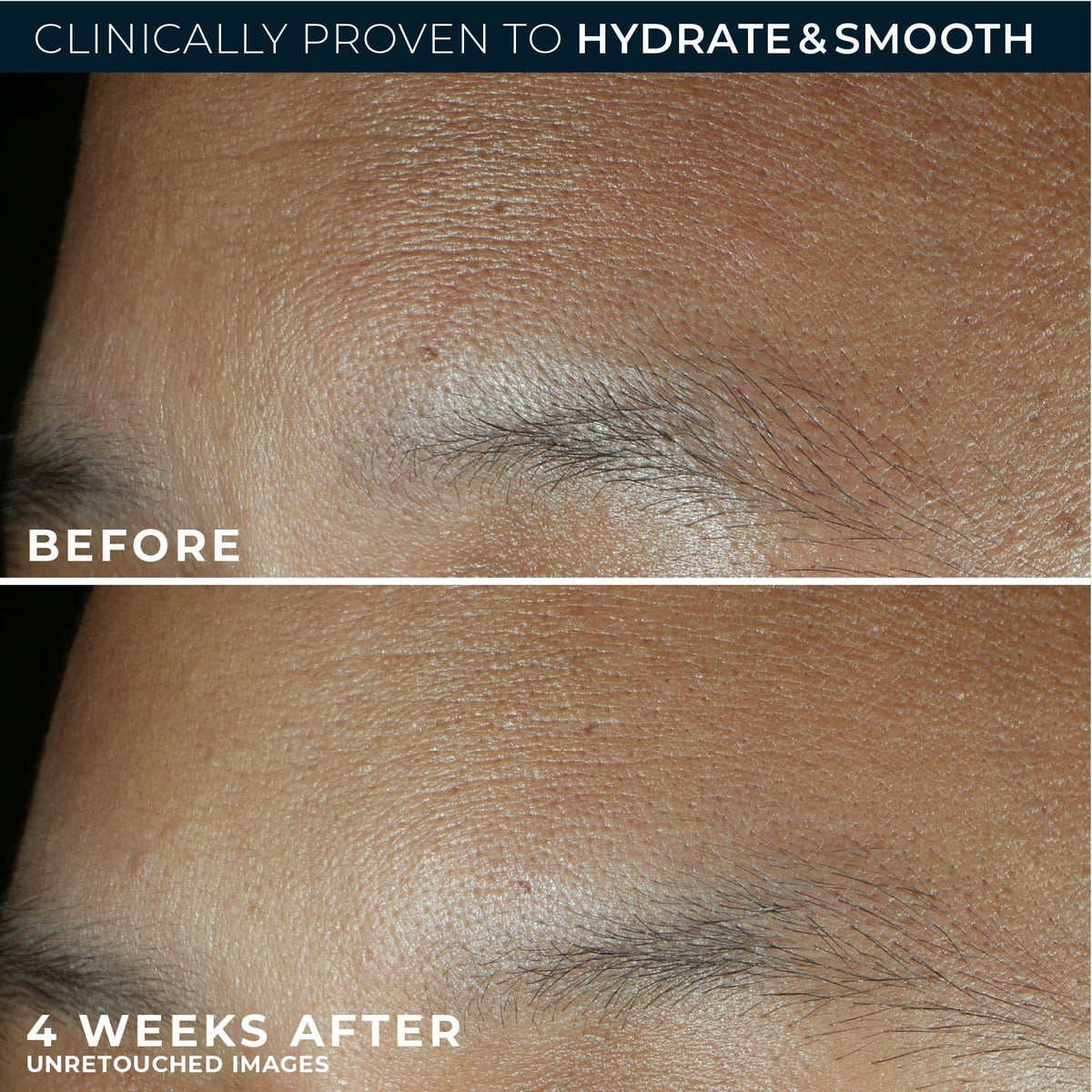 Close-up of RoC ingredient label emphasizing retinol, hyaluronic acid benefits