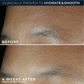 Close-up of RoC ingredient label emphasizing retinol, hyaluronic acid benefits
