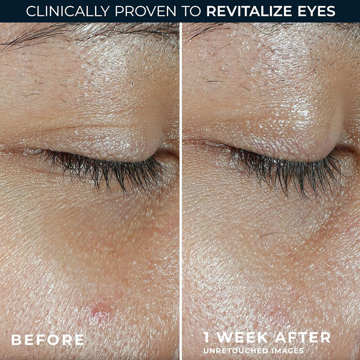RoC application on under-eye in morning routine for refreshed look