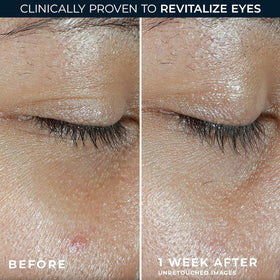 RoC application on under-eye in morning routine for refreshed look