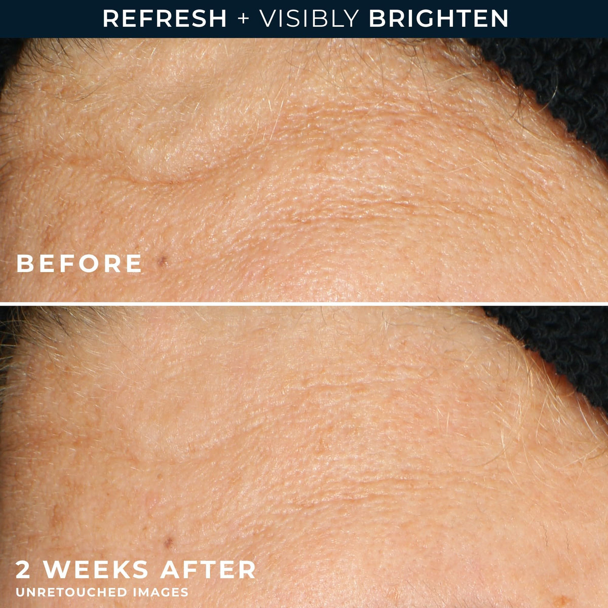 RoC ingredients panel showing glycolic acid and stabilized Vitamin C benefits