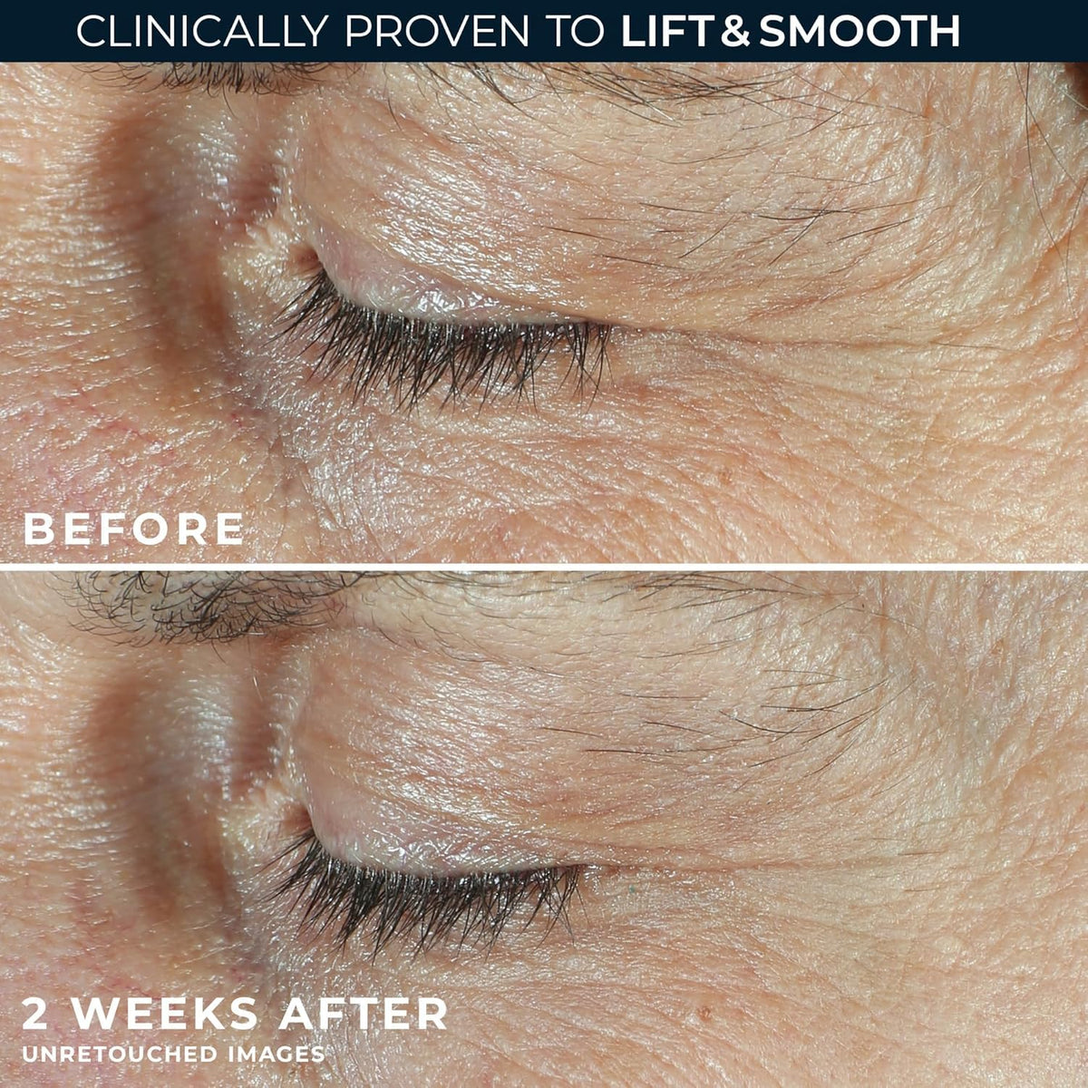 RoC white under-eye cream texture close-up for depuffing effect