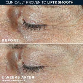 RoC white under-eye cream texture close-up for depuffing effect