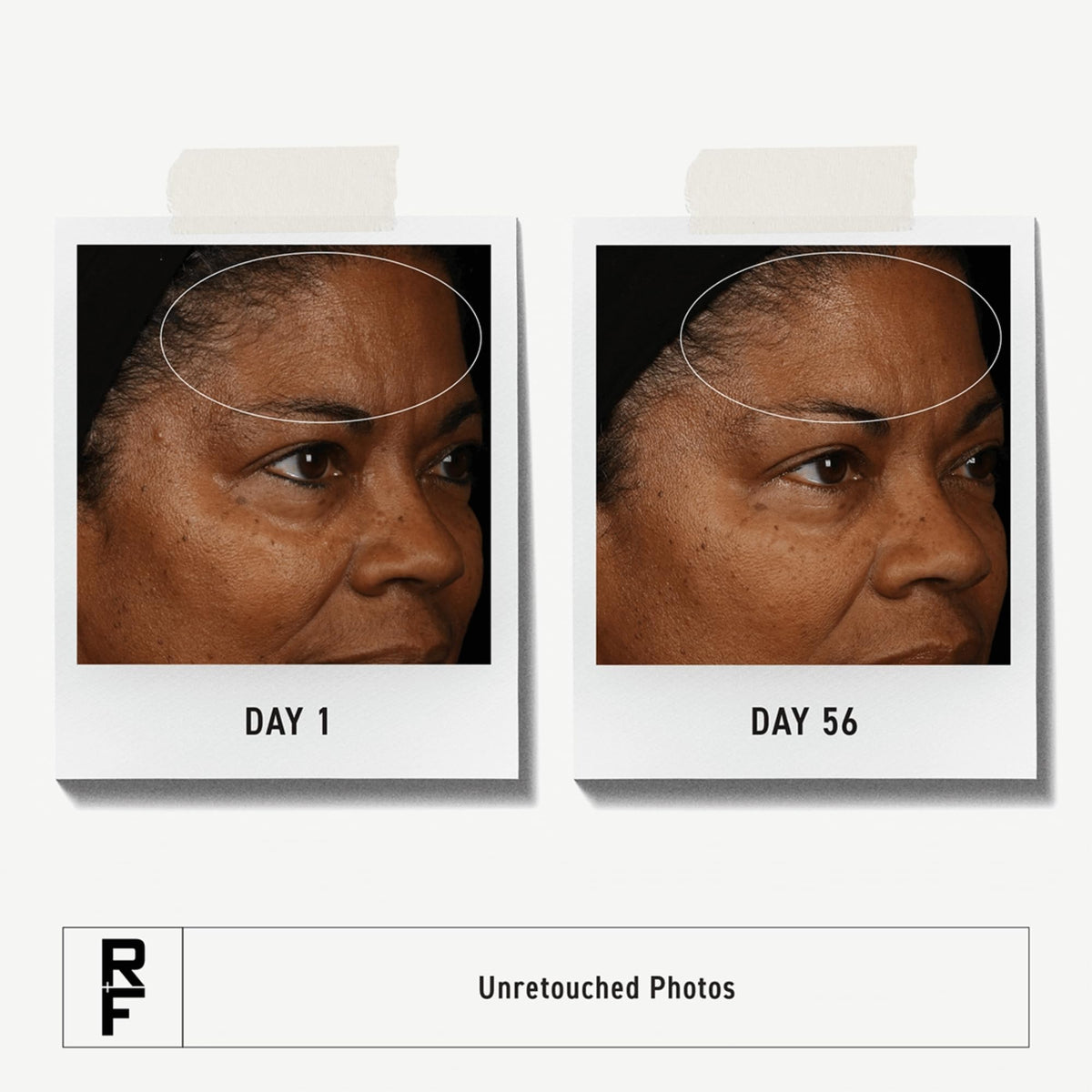 RODAN + FIELDS clay cream close-up highlighting smooth exfoliating texture