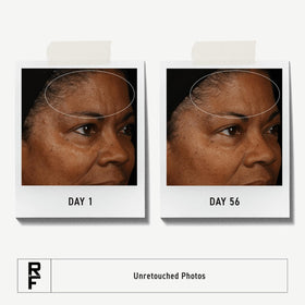 RODAN + FIELDS clay cream close-up highlighting smooth exfoliating texture