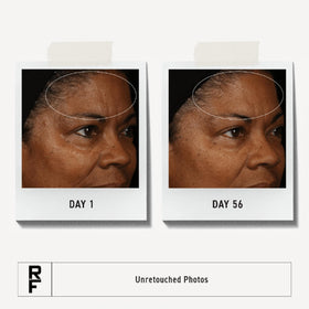 RODAN + FIELDS cream spread on hand demonstrating smooth application benefit