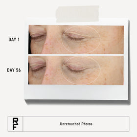 RODAN + FIELDS open jar showing creamy texture for smooth hydration benefit