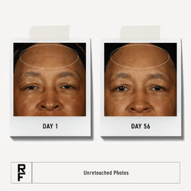 RODAN + FIELDS open jar texture close-up showing rich moisturizing cream