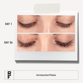 Rodan + Fields close-up applicator tip highlighting precise nightly application