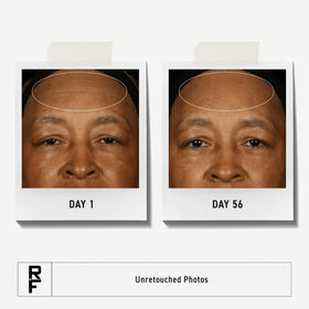 RODAN + FIELDS open tube with product texture visible to show creamy clay