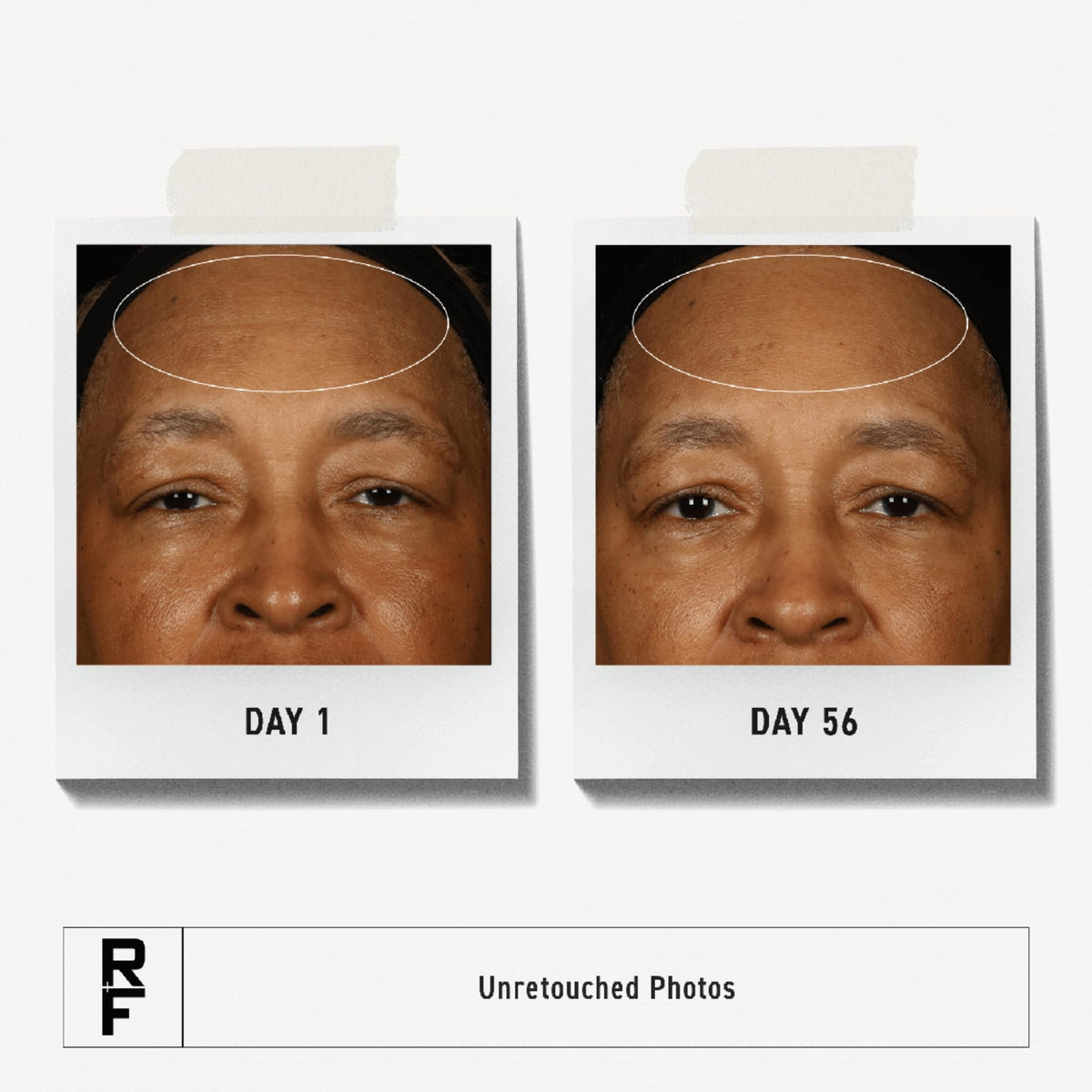 Rodan + Fields cream in hand for size and travel-friendly convenience