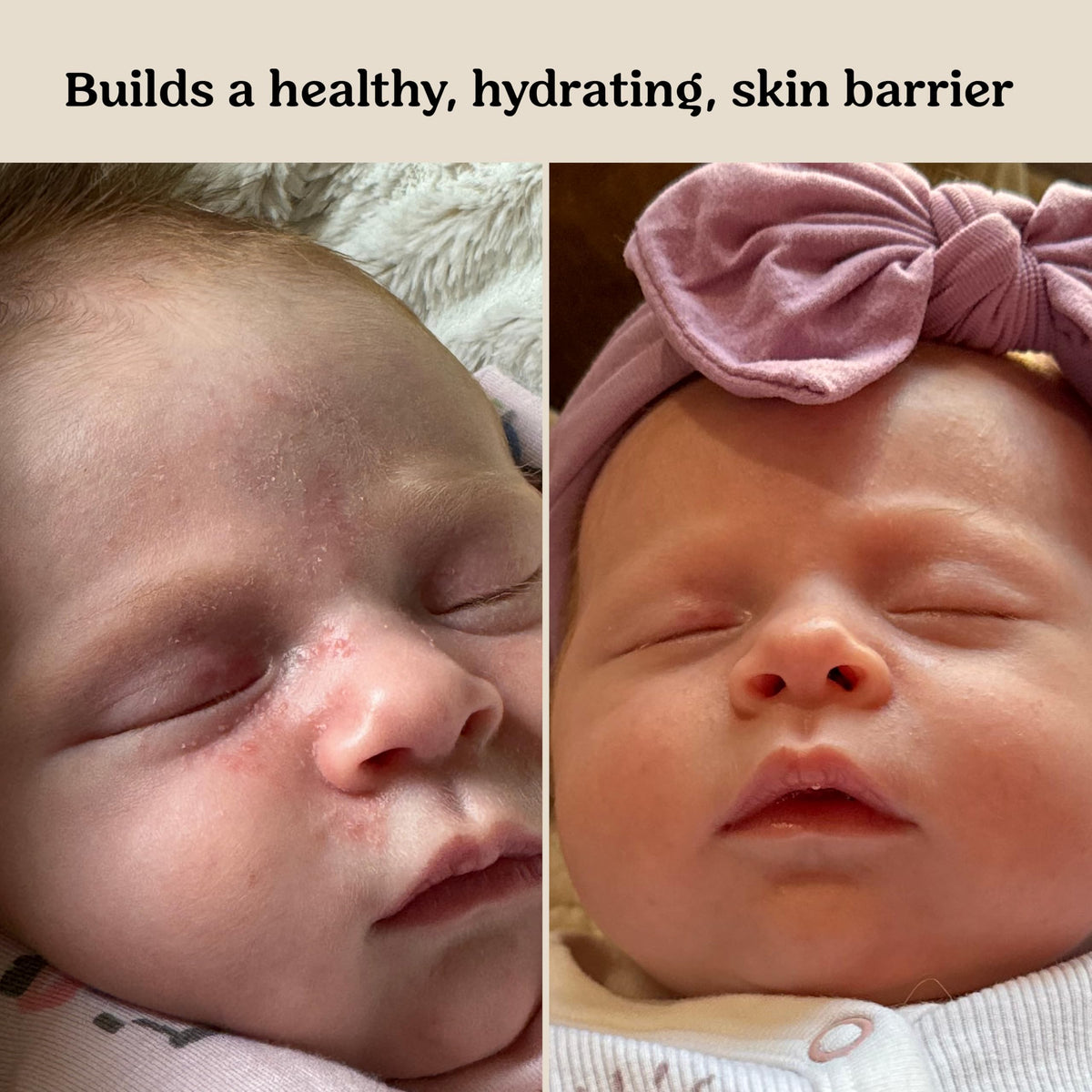 Roe Wellness application on baby cheek illustrating gentle soothing benefit