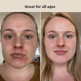 Roe Wellness serum on parent hand demonstrating fast absorption and softness