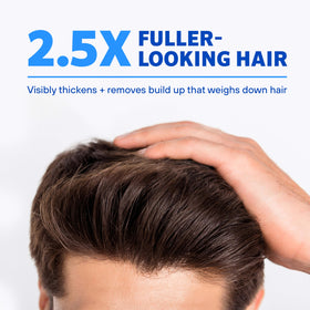 Rogaine label close-up highlights formula and ingredient details