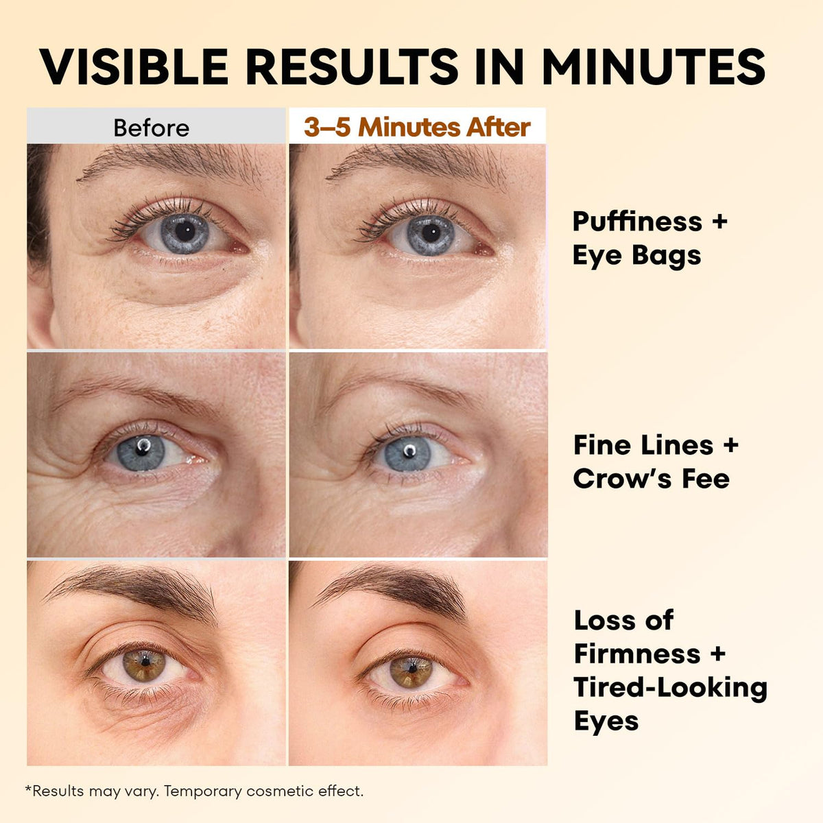 RONKIE application under eye demo showing quick visible tightening